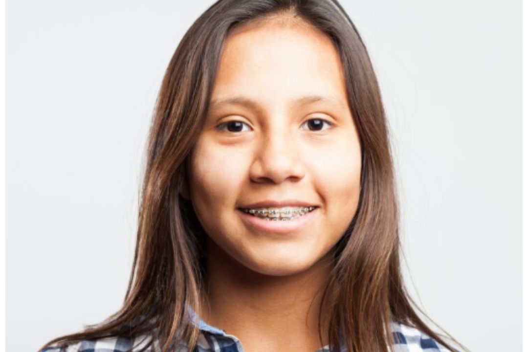 3 months braces price in mumbai